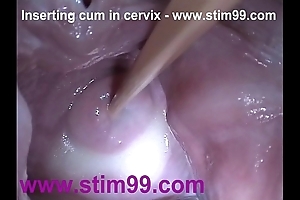 Wrapround goo cum in cervix thither stretching pussy reflector